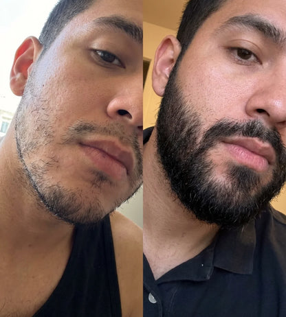 Bálsamo Estimulante de Barba Apolo